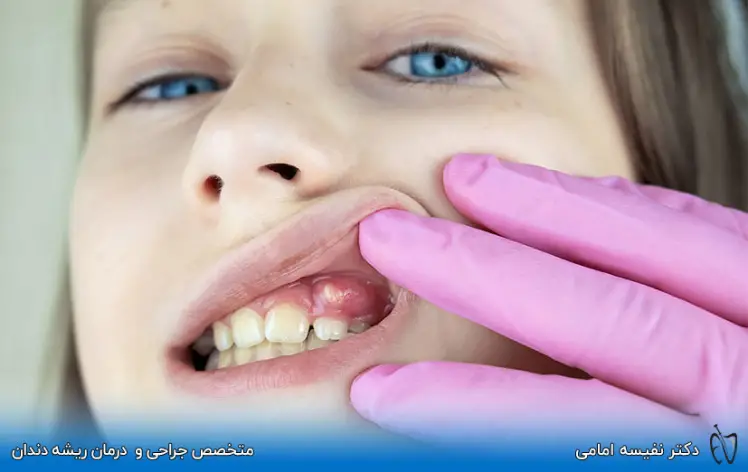 بررسی نشانه های عفونت دندان