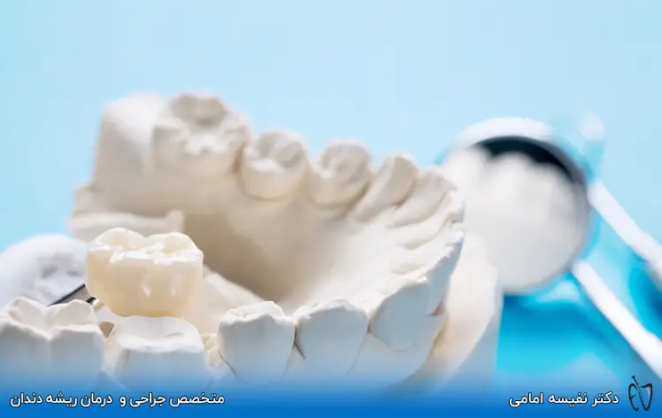 آیا روکش دندان عصب کشی شده الزامی است؟