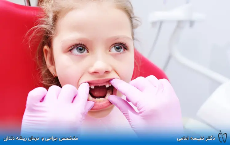 تحلیل و بررسی ریشه دندان شیری