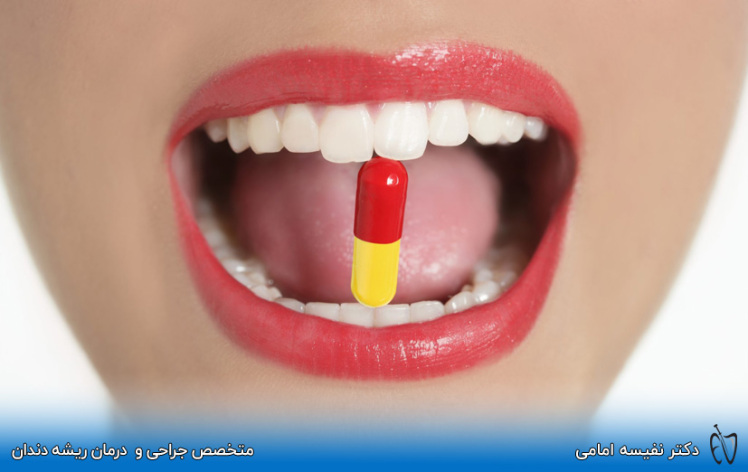 مصرف آنتی بیوتیک و مسکن بعد از کشیدن دندان