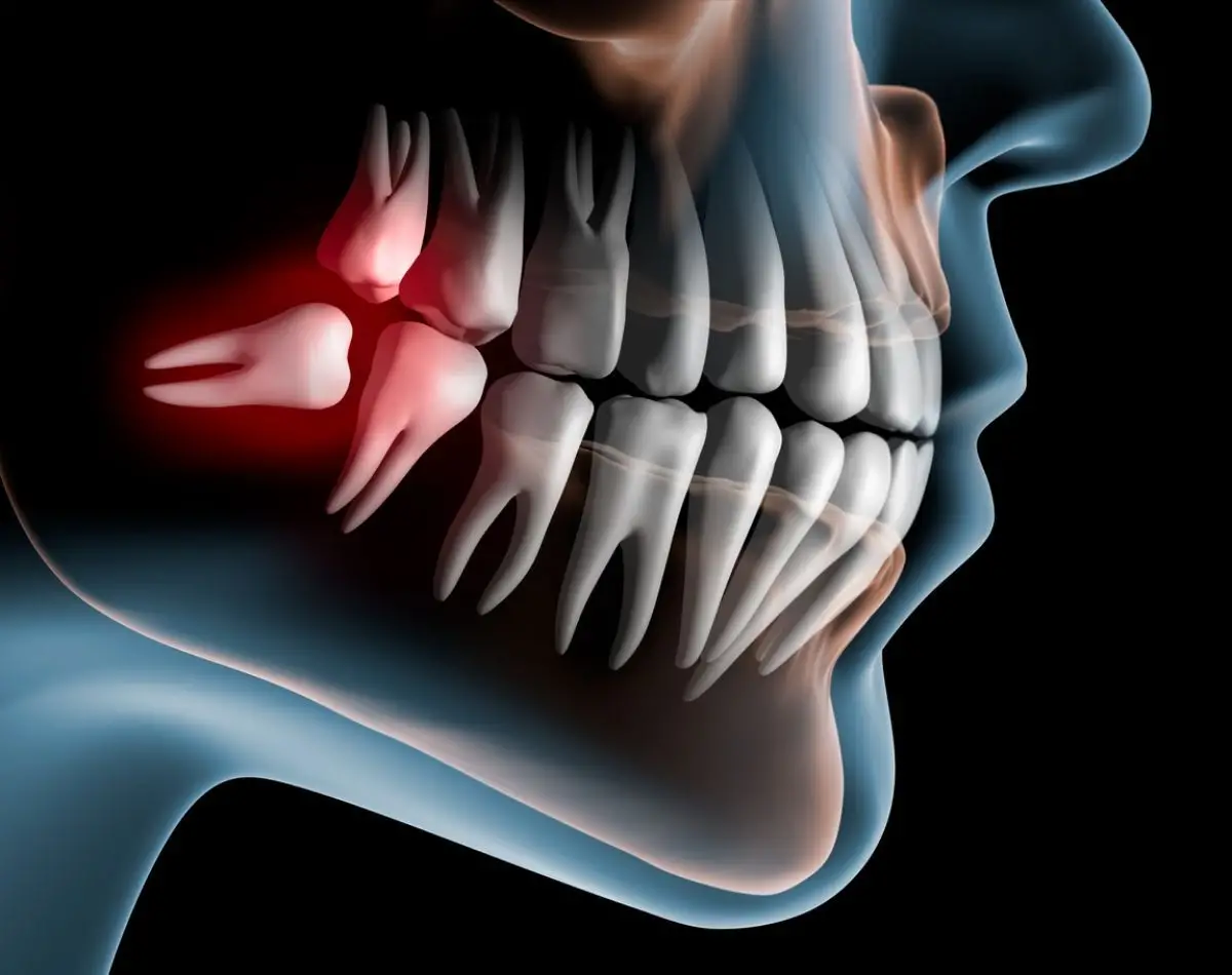 دلایل درد ضربان دار دندان